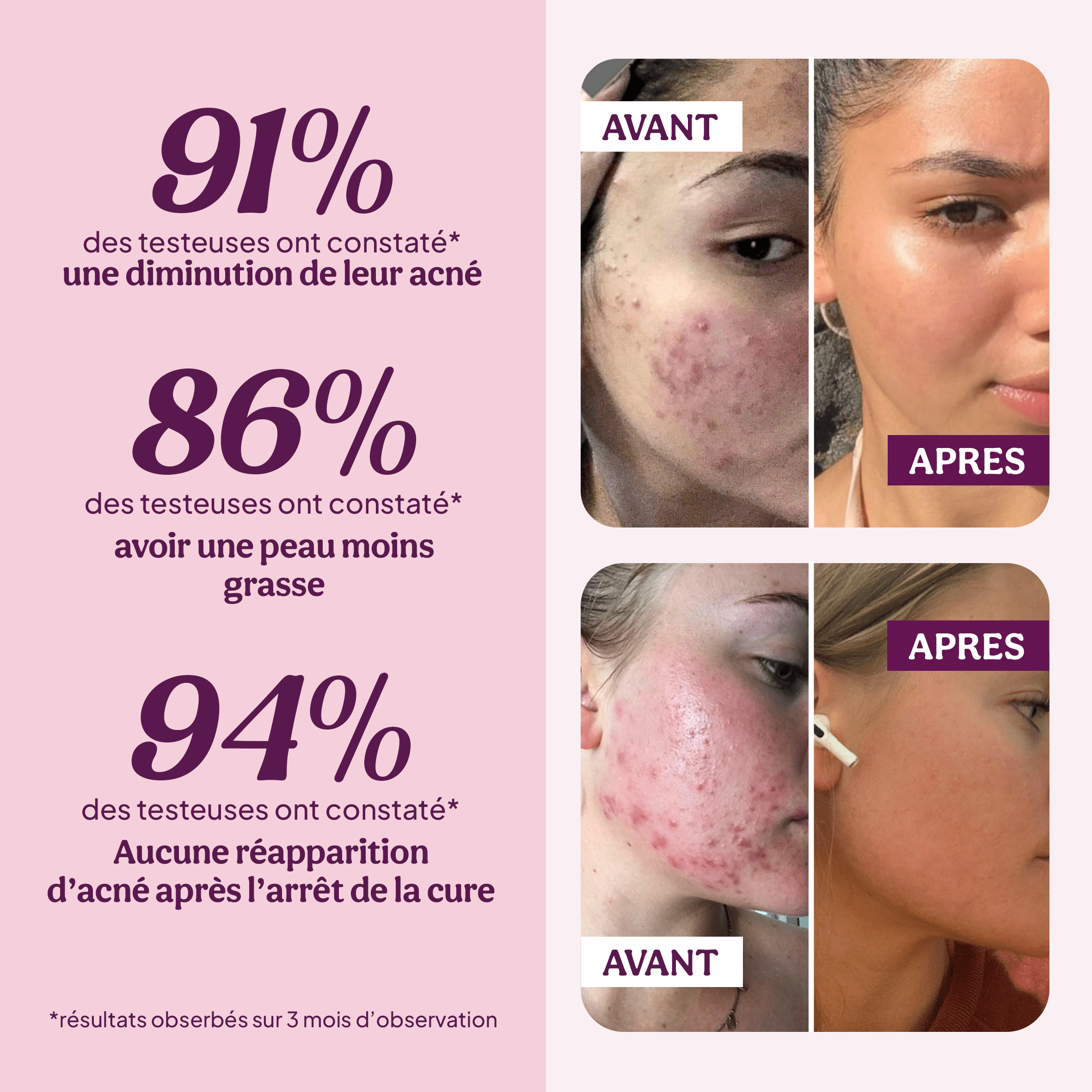 Balance ton Cycle - angle pilule cible 6 - acné